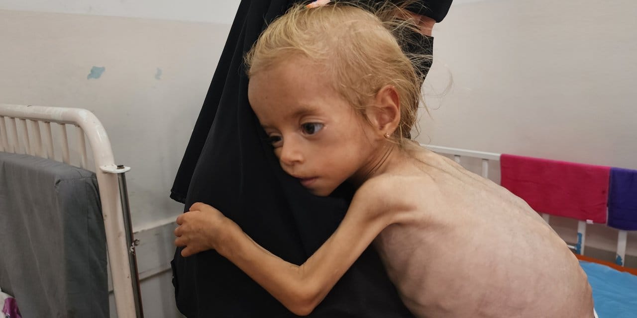 Gazze'de açlıktan ölmek 'sıradanlaştı'