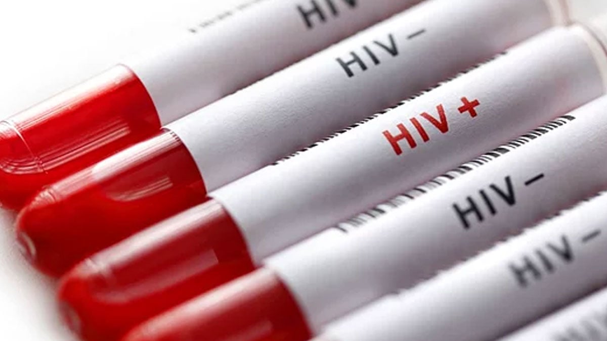 Tıpta çığır açan araştırma: HIV virüsü tarihe mi karışıyor?