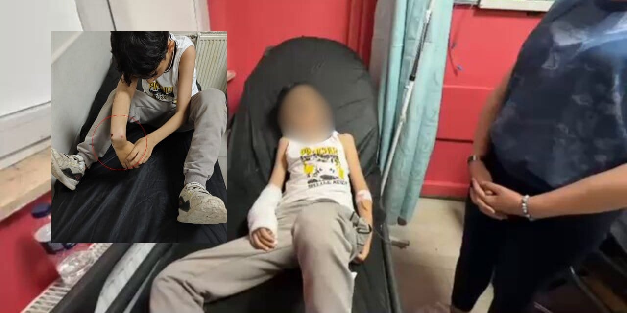 Kolunu kırdığı iddia edilen çocuktan şikayetçi oldu