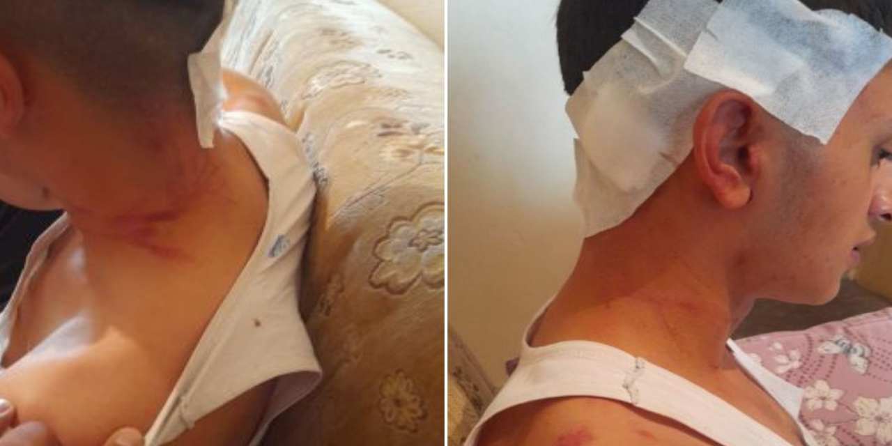 MHP’li başkanın oğulları hakkında darp iddiası: Kamera kayıtları kayıp