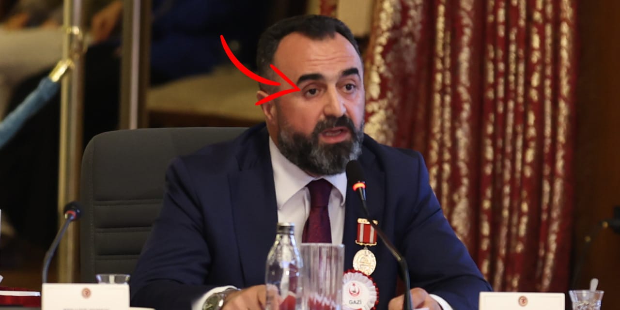 Sürece destek veren gaziden şoke eden hareket! Komisyonda gözünü eline aldı