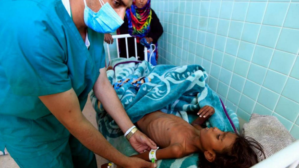 Yemen’de kolera salgınından 200 bin çocuk etkilendi