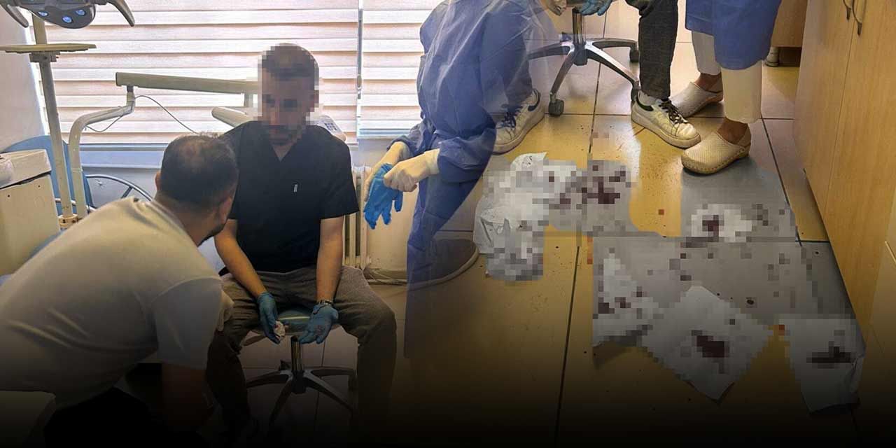 İzmir’de çileden çıkaran olay! Randevusuz muayene olmak istedi: Diş hekimini kafa atarak yaraladı