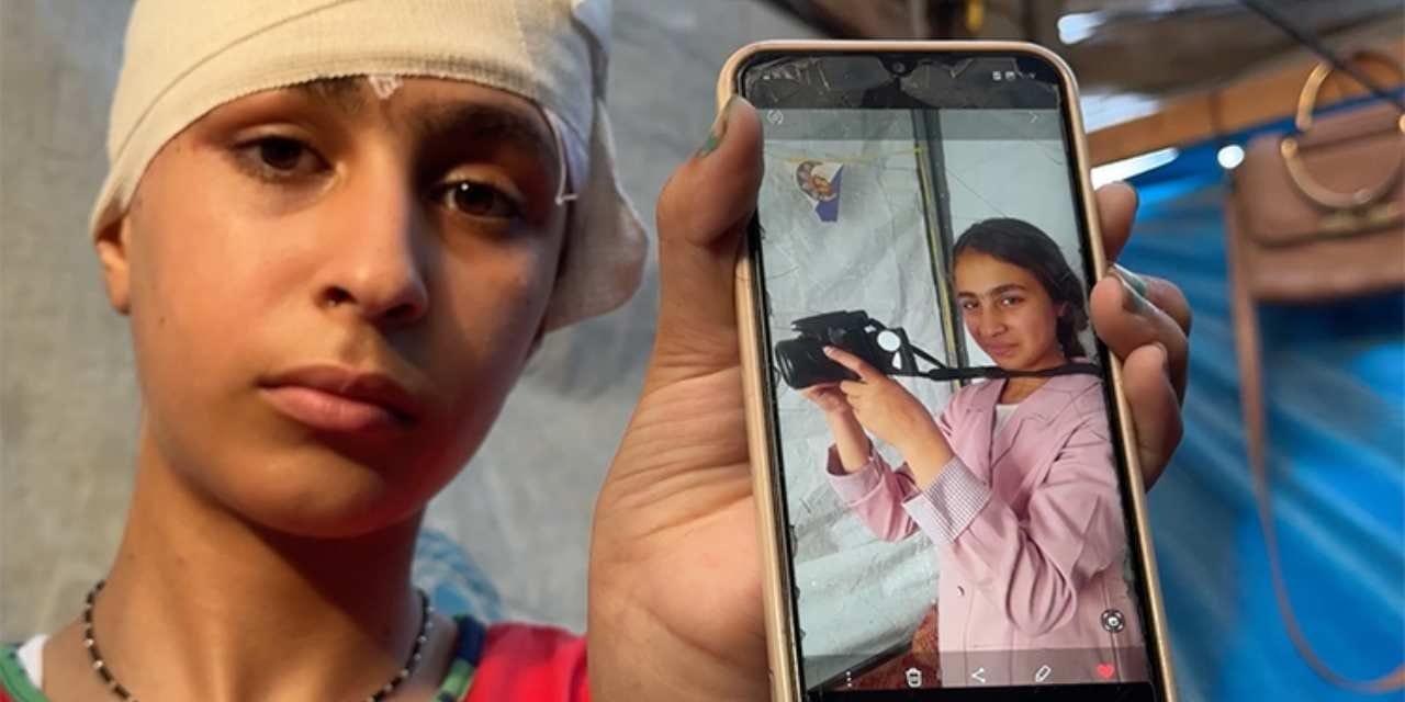 Gazze'de 42 bin kişi “hayat değiştiren” yaralanmaya maruz kaldı