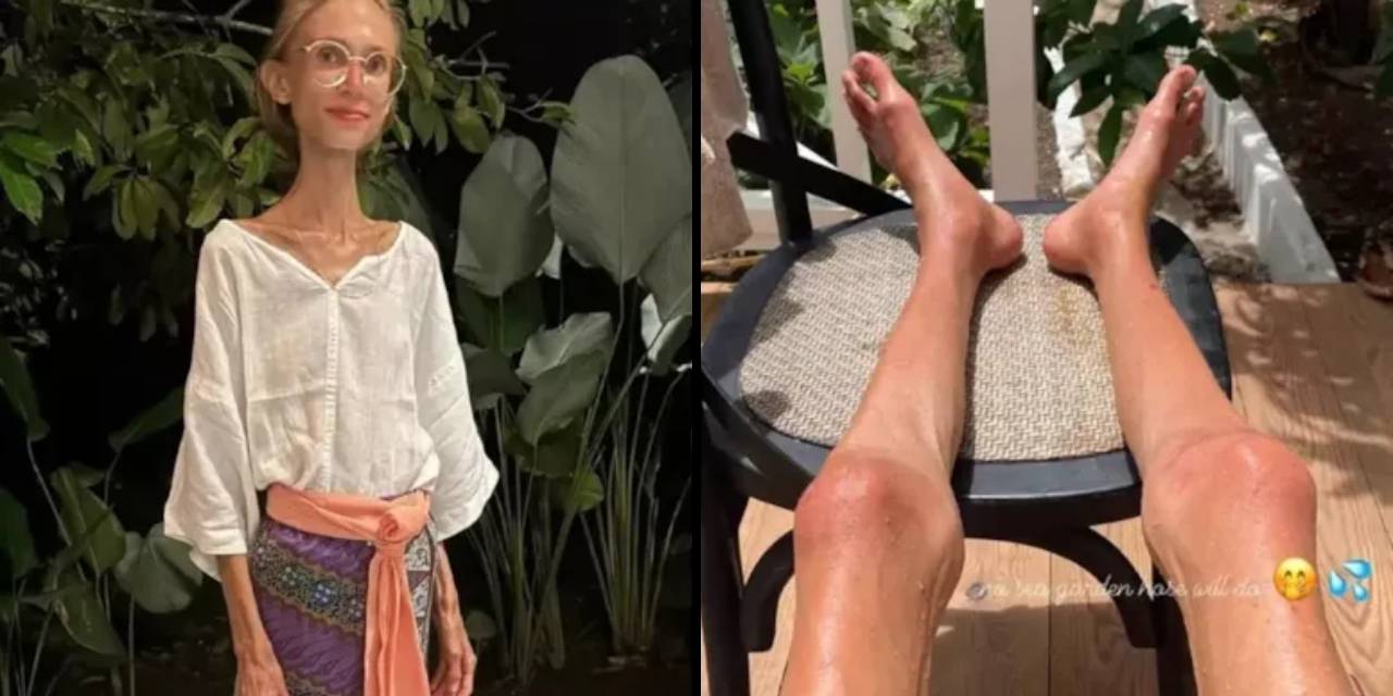 ‘Meyvecilik’ akımı hayatına mal oldu