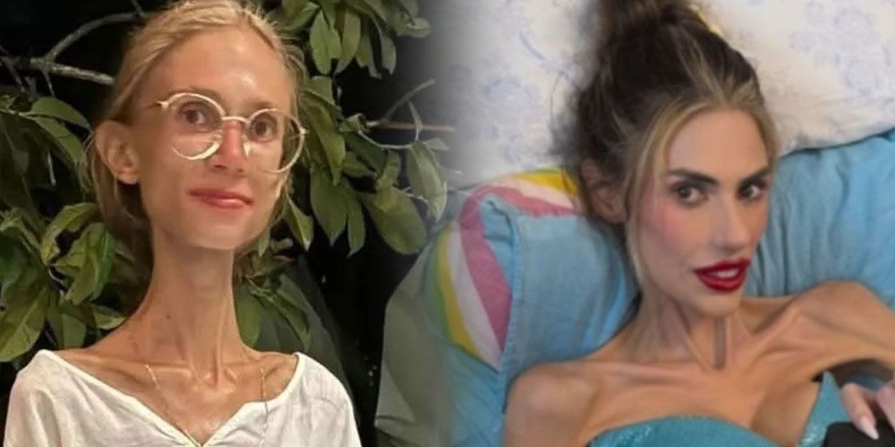 22 kiloya düşen fenomen hayatını kaybetti: Akıllara Nihal Candan geldi