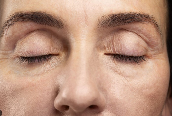 Göz Şişkinliğine İyi Gelen 8 Öneri