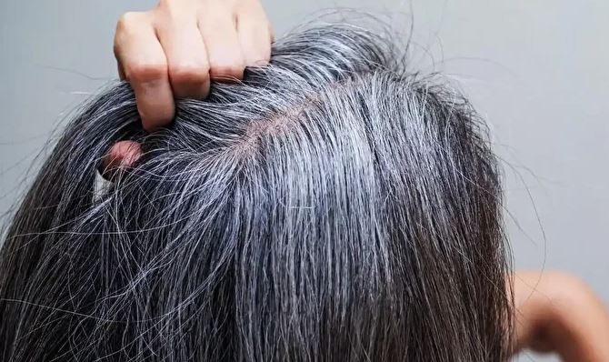 Saçlarımız neden grileşir ve beyazlar?