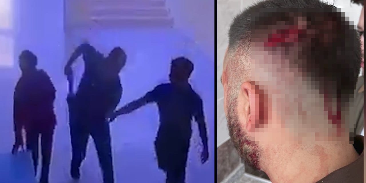 Öğrencilerinin gözü önünde öğretmene demir sopayla saldırdı