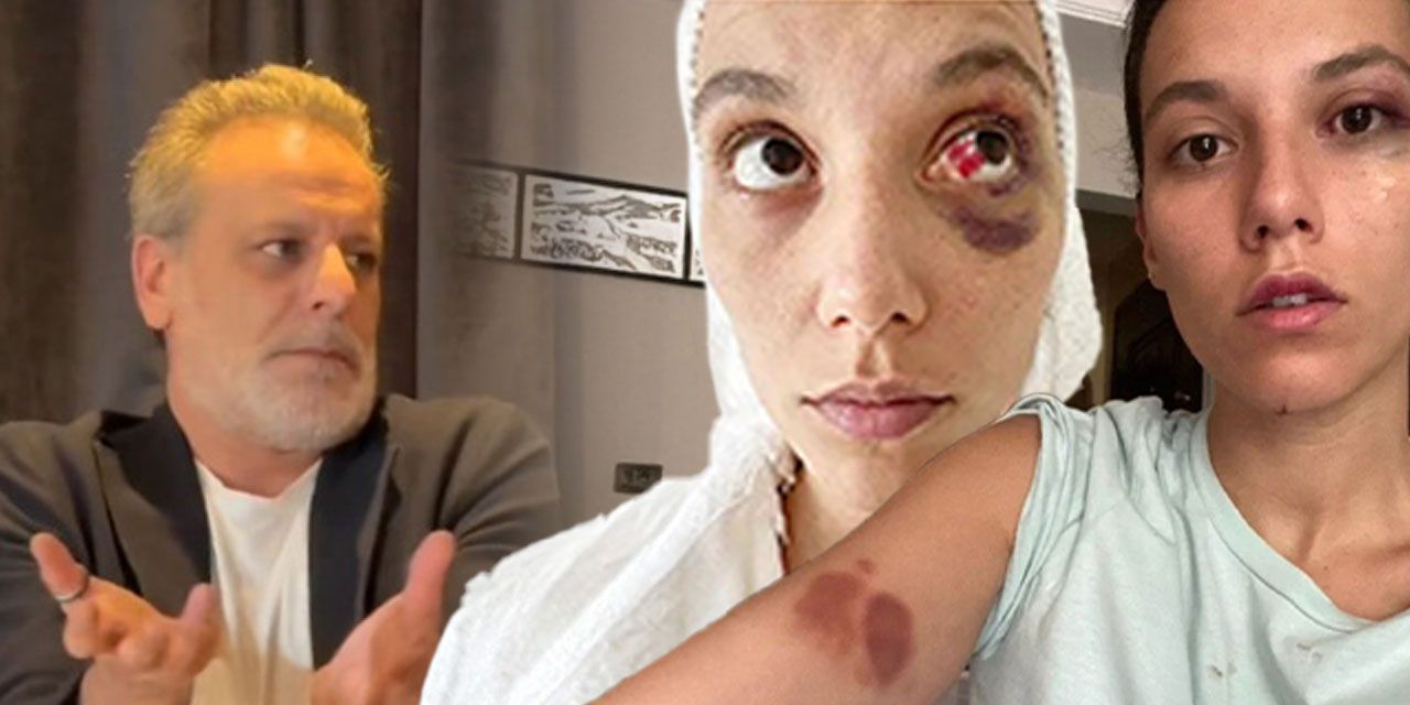 Kadına şiddetten hapis yatacak Ozan Güven'den skandal savunma! Abajurla Deniz Bulutsuz'u darbetmişti
