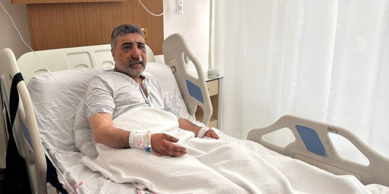 İngiliz boksörün darp ettiği taksicinin davası görüldü: Geceleri bağırarak uyanıyorum