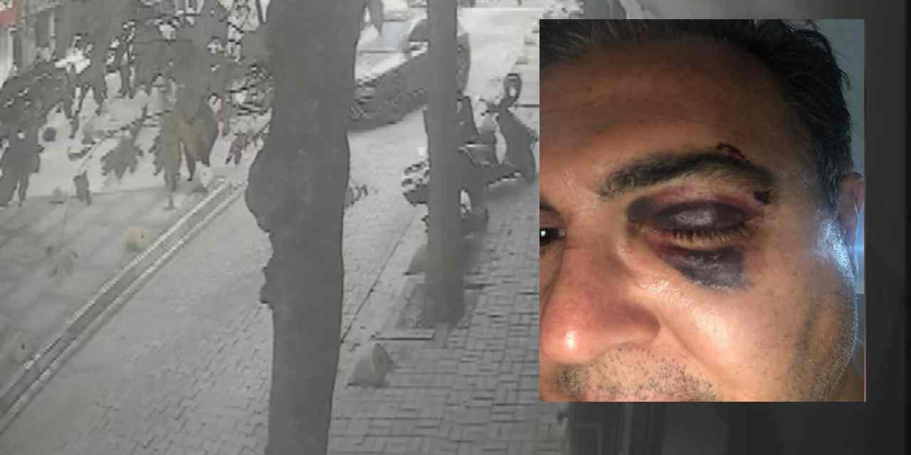 Kedi besliyordu... Bir anda neye uğradığını şaşırdı! İstanbul'da iş insanına saldırı