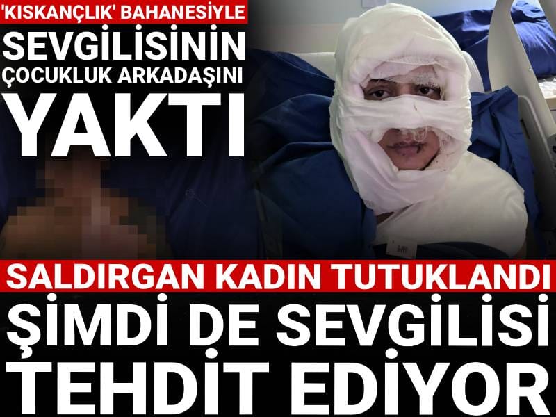 'Kıskançlık' bahanesiyle sevgilisinin çocukluk arkadaşını yaktı! Saldırgan tutuklandı: Şimdi de sevgilisi tehdit ediyor