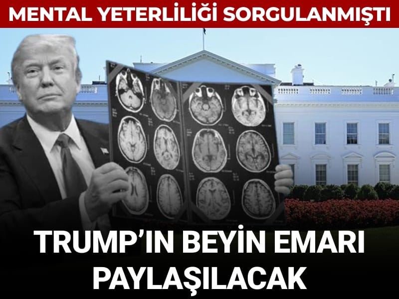 Mental yeterliliği sorgulanmıştı: Trump'ın beyin emarı paylaşılacak