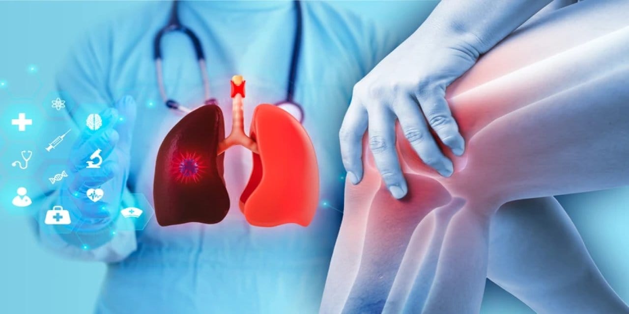 Diz ve omuzdaki ağrı akciğerlerinizin çığlığı olabilir