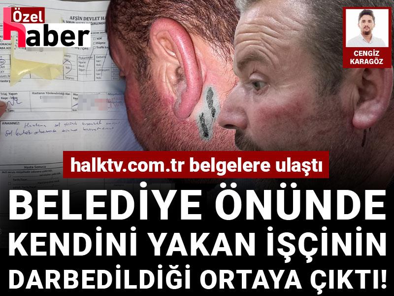 Belediye önünde kendini yakan işçinin darbedildiği ortaya çıktı!