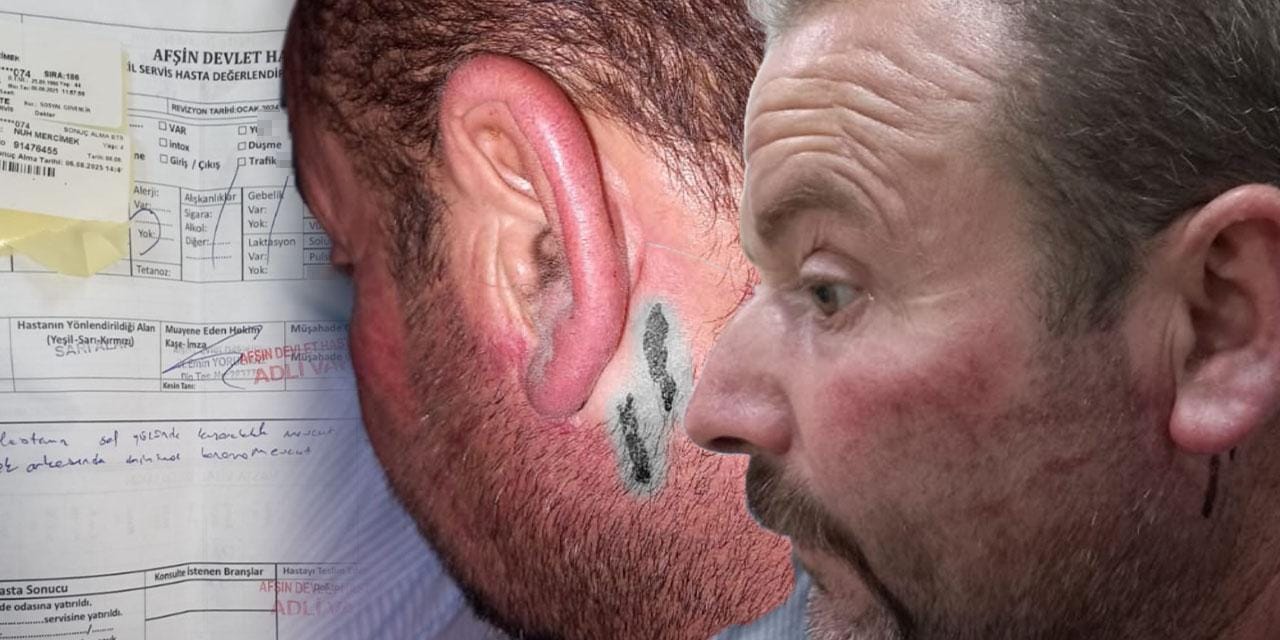 Belediye önünde kendini yakan işçinin darbedildiği ortaya çıktı!