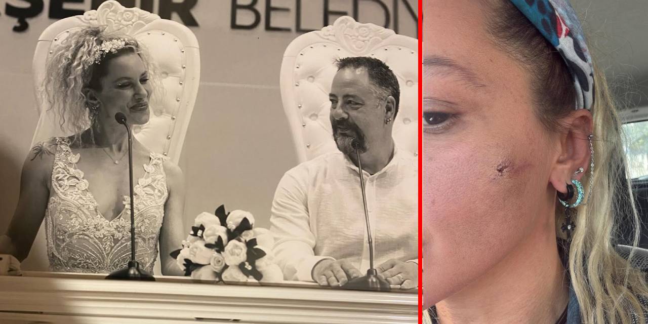 Yıldız Asyalı'dan şoke eden iddia: Eşim tarafından darp edildim