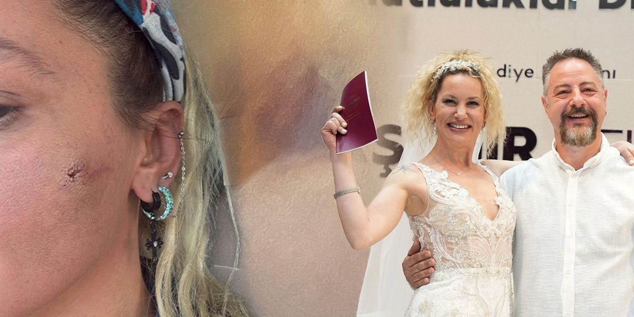 Yıldız Asyalı "darp edildim" diyerek paylaşmıştı: Eşi sessizliğini bozdu