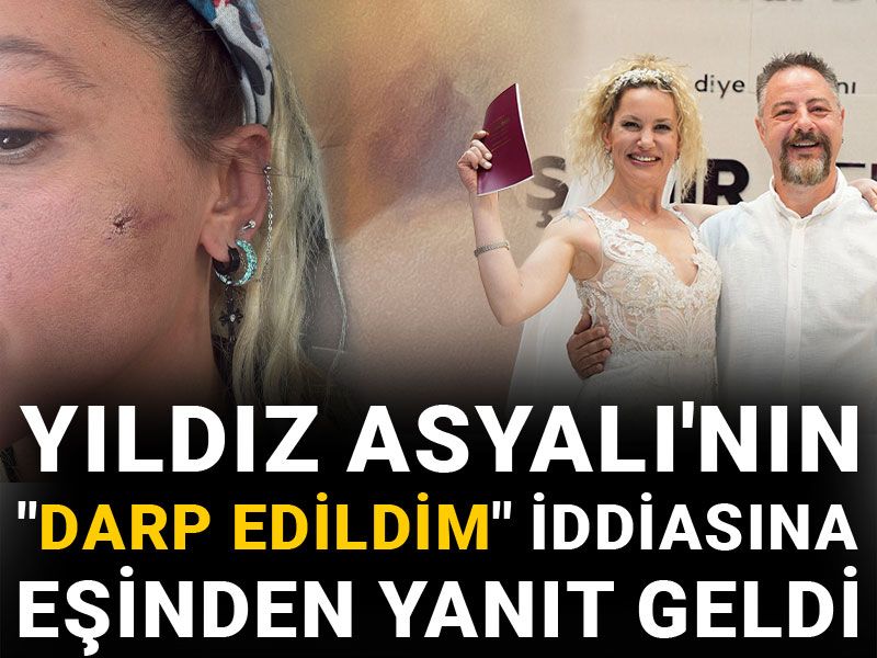 Yıldız Asyalı "darp edildim" diyerek paylaşmıştı: Eşi sessizliğini bozdu
