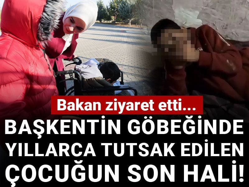 Başkentin göbeğinde yıllarca tutsak edilen çocuğun son hali! Bakan ziyaret etti...