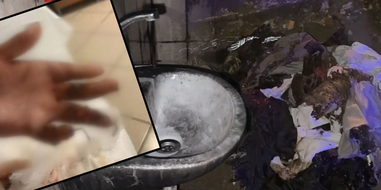 Kuaförde kabusu yaşadı, 14 yaşındaki Engin'in tüm vücudu yandı: O anları anlattı