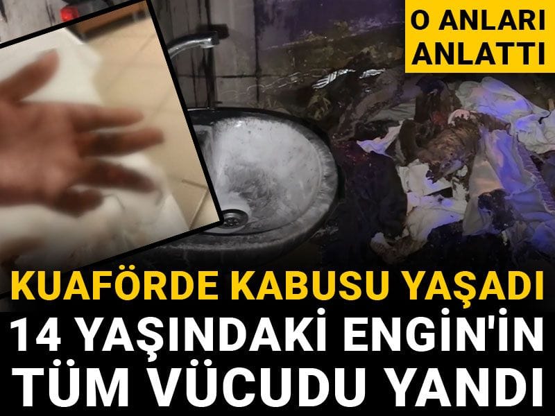 Kuaförde kabusu yaşadı, 14 yaşındaki Engin'in tüm vücudu yandı: O anları anlattı