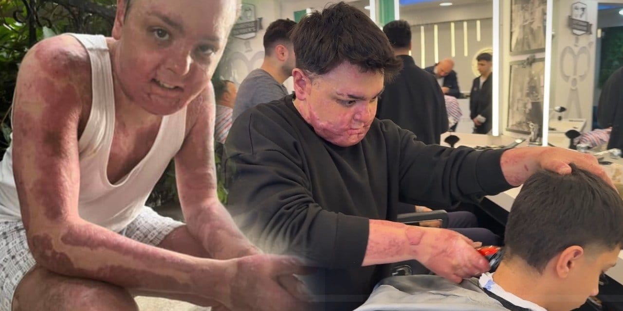 Ölümden döndü pes etmedi: 65 operasyon sonrası hayata sımsıkı tutundu