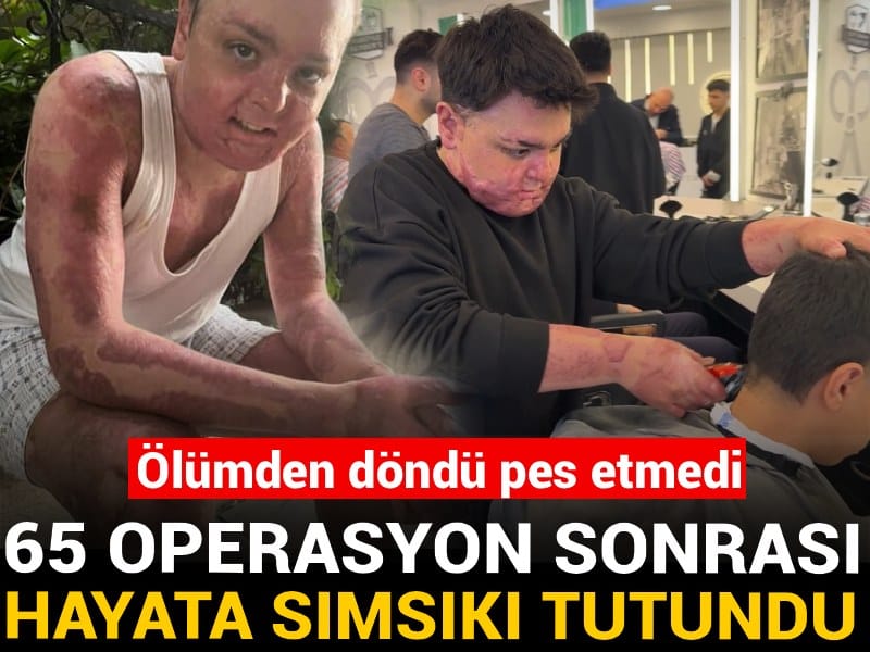 Ölümden döndü pes etmedi: 65 operasyon sonrası hayata sımsıkı tutundu