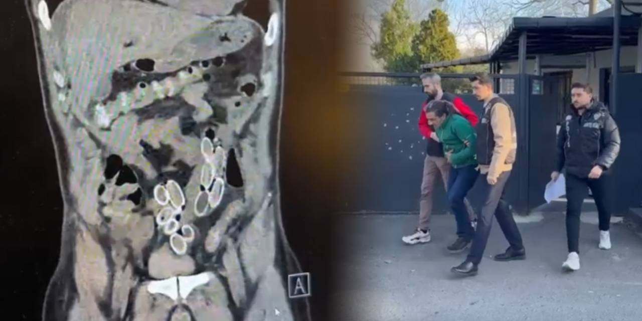 Midesindeki uyuşturucuyla 3 bin kilometre yol geldi!