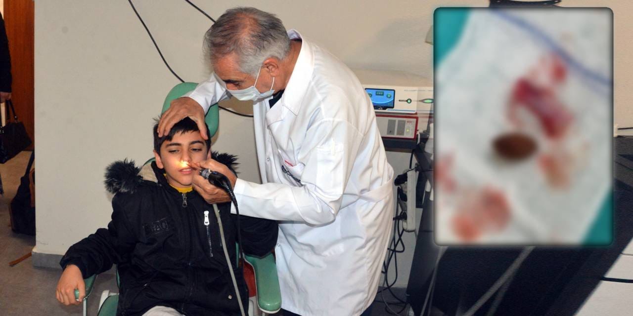 Kaşıntı şikayetiyle gitti: Burnundan çıkanlar şoke etti