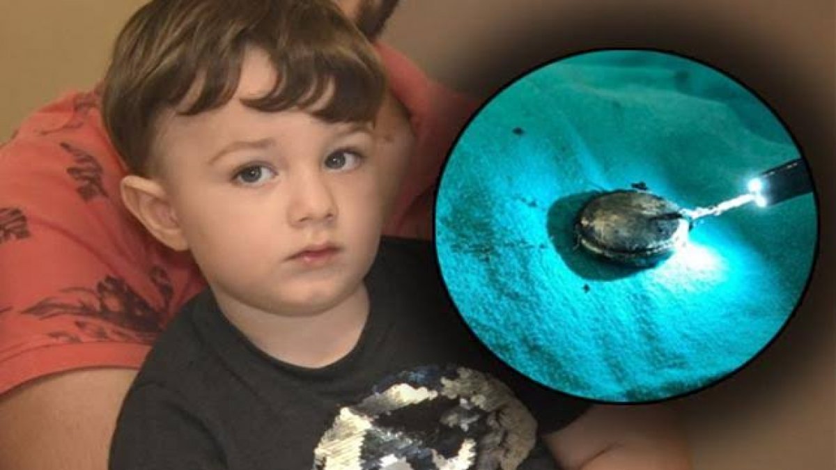 2,5 yaşındaki minik Bora ölümden döndü!