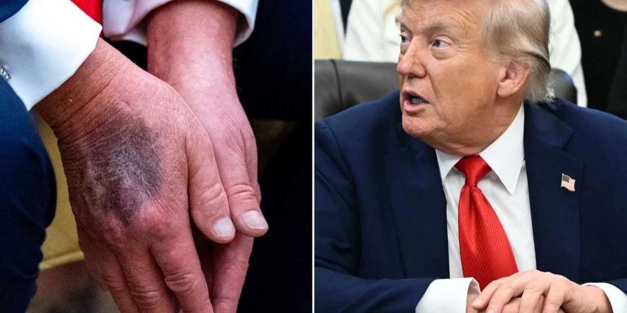 Aspirin gerçekten ömrü uzatıyor mu? Trump doz aşımı yapacak kadar kullanınca iddia alevlendi