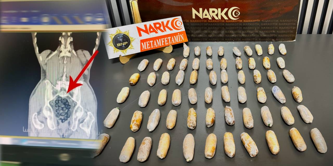 Şüpheli hareketler yakayı ele verdi: Yolcunun midesinden 472 gram uyuşturucu çıktı