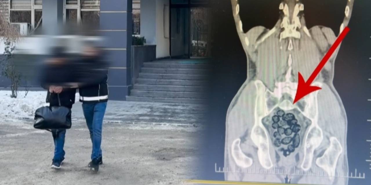 Zehir tacirlerinin akılalmaz yöntemi: Uyuşturucu midesinden çıktı