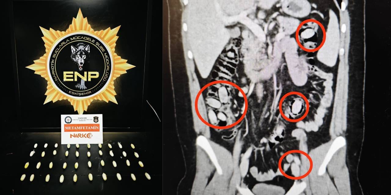 Midesinde sakladı: Kent girişinde yakalandı!