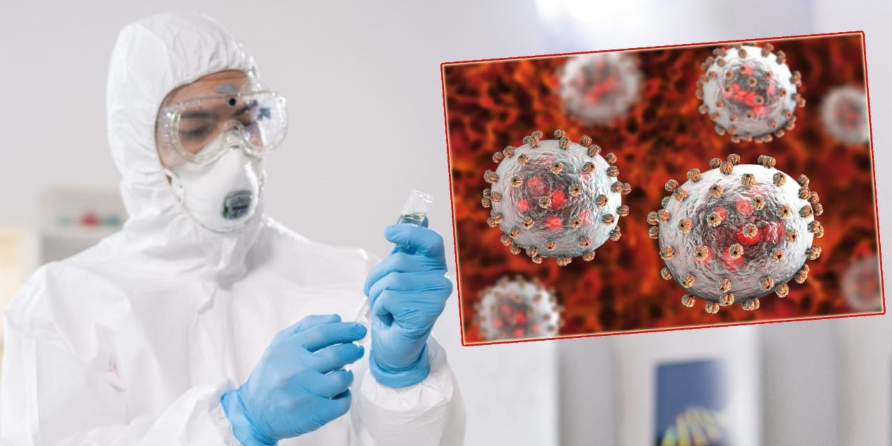 Yetkililer uyarıyor: Lassa virüsü 215 can aldı!