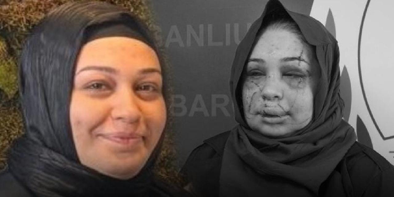 Boşanmak isteyen eşini bayıltıp yüzünü parçaladı! Polis koca serbest