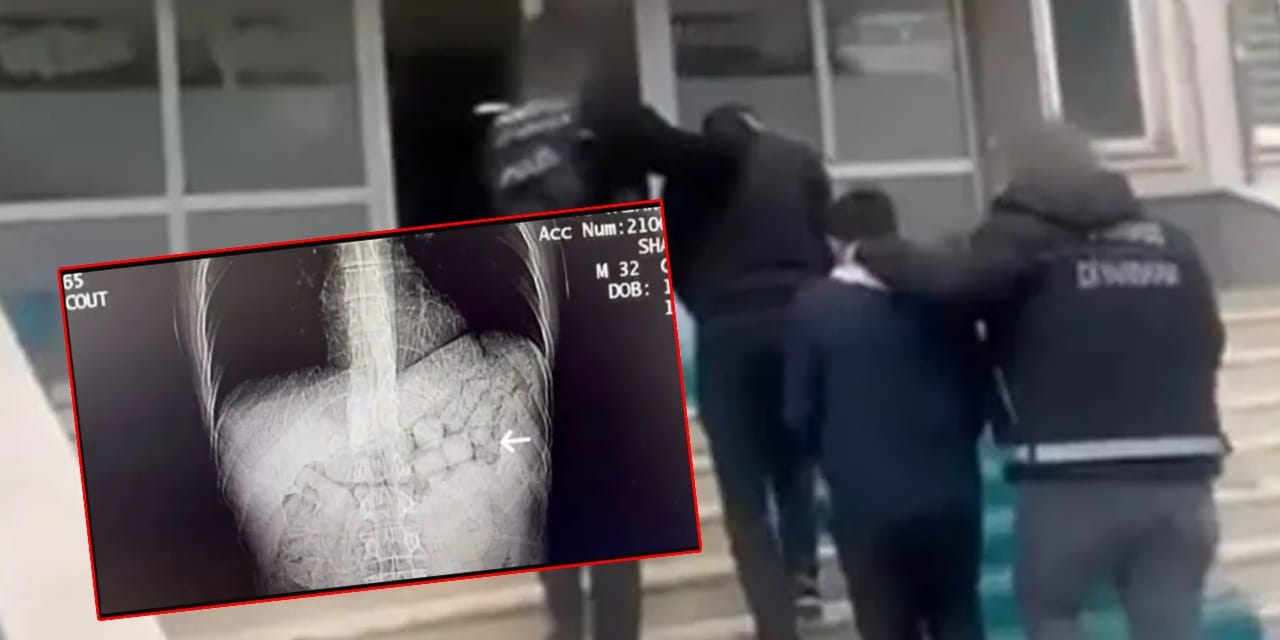 İranlı uyuşturucu tacirleri Diyarbakır'da yakalandı: Karnından 1 kiloya yakın metamfetamin çıktı