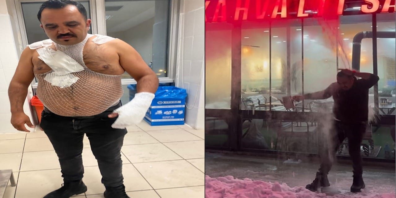 Soğuk havayı test etmek isterken kendini yaktı