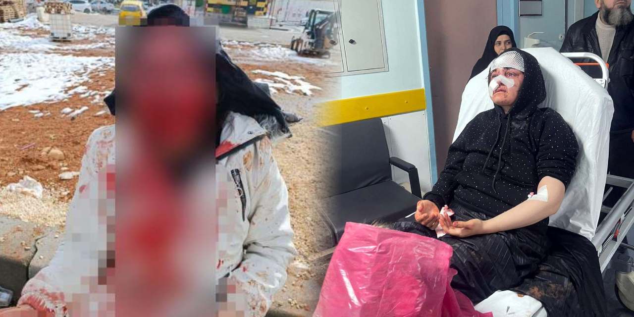 Boşanma aşamasında olduğu kadını kaldırım taşıyla öldürmeye çalıştı!