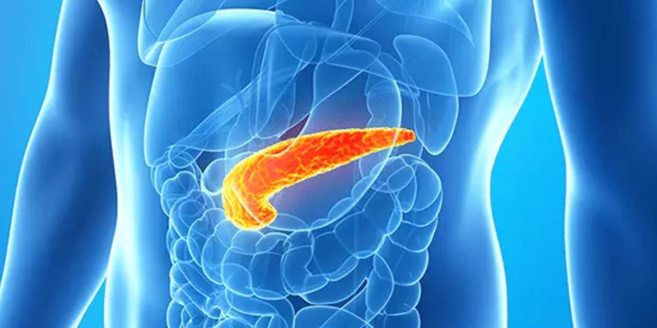 Pankreas kanserinde umut veren gelişme: Üçlü tedaviyle tümörler yok edildi