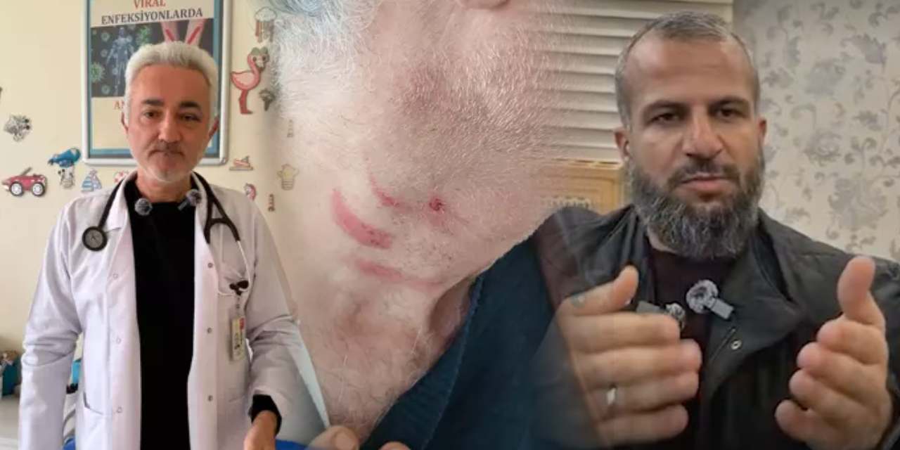 Doktorun kulak zarı yırtıldı müezzin 'kendimi savundum' dedi! Konya'yı karıştıran sıra kavgası