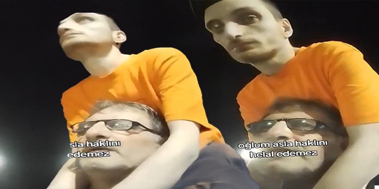 31 yaşındaki oğlunu omzunda taşıyan baba isyan etti: Otizmi bitiremeyiz o bizi bitirecek