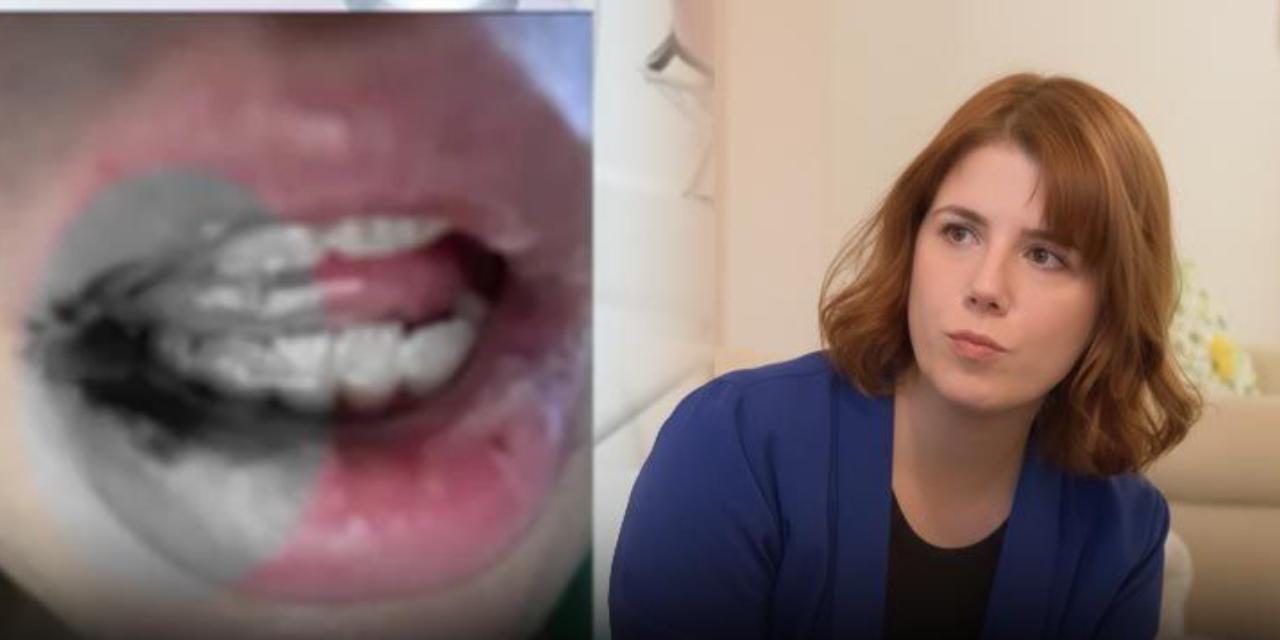 Ağzı çürüyünce gerçek ortaya çıktı! Dişinde "eğe" unutulmuş