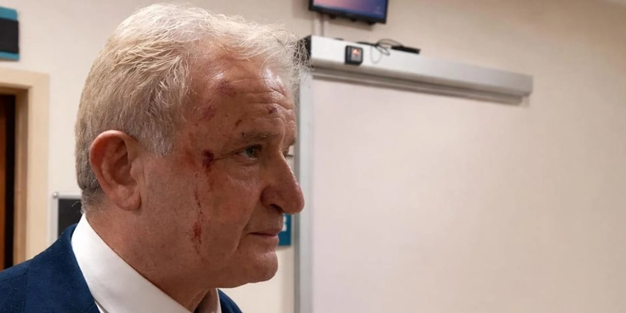 Eskişehir'de gazeteciye yumruklu saldırı!