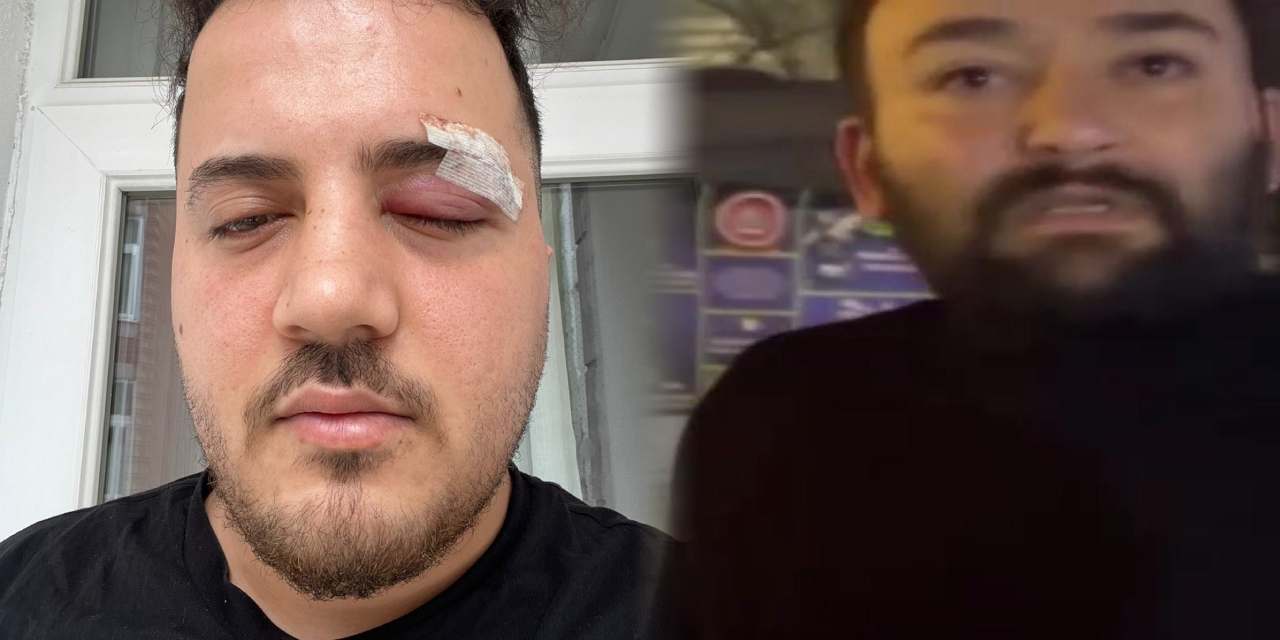 Tartıştığı sürücüye ölüm tehditleri savurup darbetti! Kamerayı görünce tanımazlıktan geldi