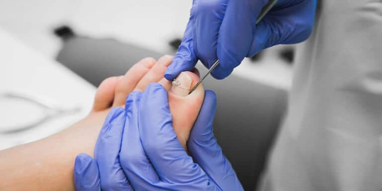 Epsom tuzu banyosu yetmez...Adım adım diş ipi operasyonuyla tırnak batmasından kurtulun!