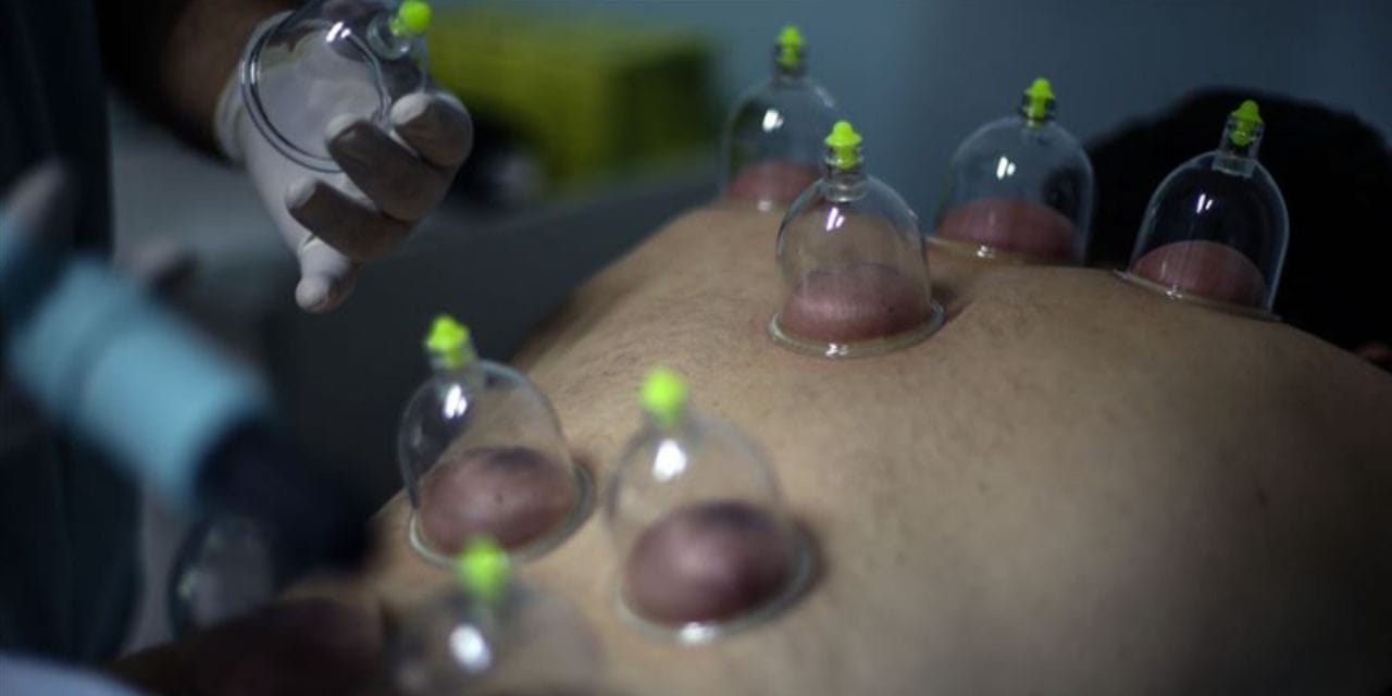 Kamu bütçesinden hacamata pay! CHP'li Şahbaz düzenlemeye tepki gösterdi: "Elveda modern tıp, yaşasın sülük, ot..."