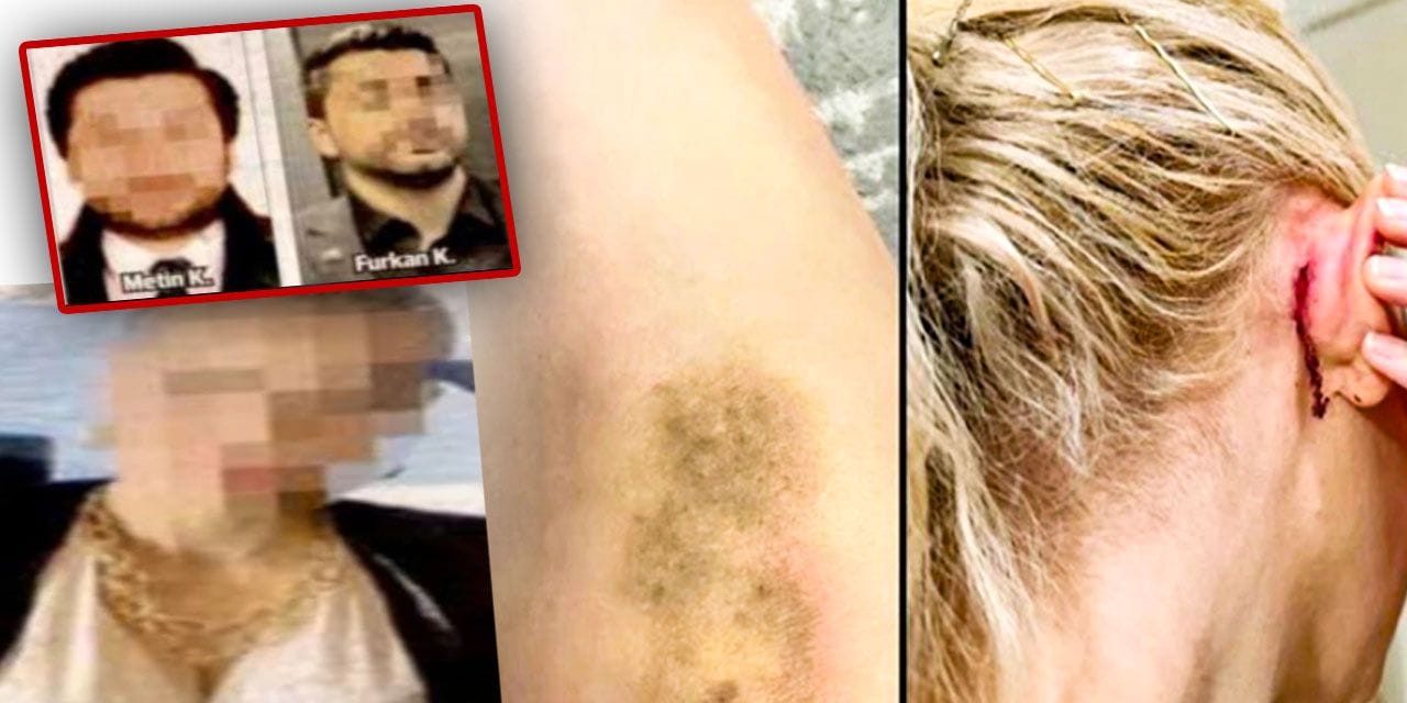 Ünlülerin avukatına saldırı: Kulağı yırtıldı saçlarından sürüklendi!